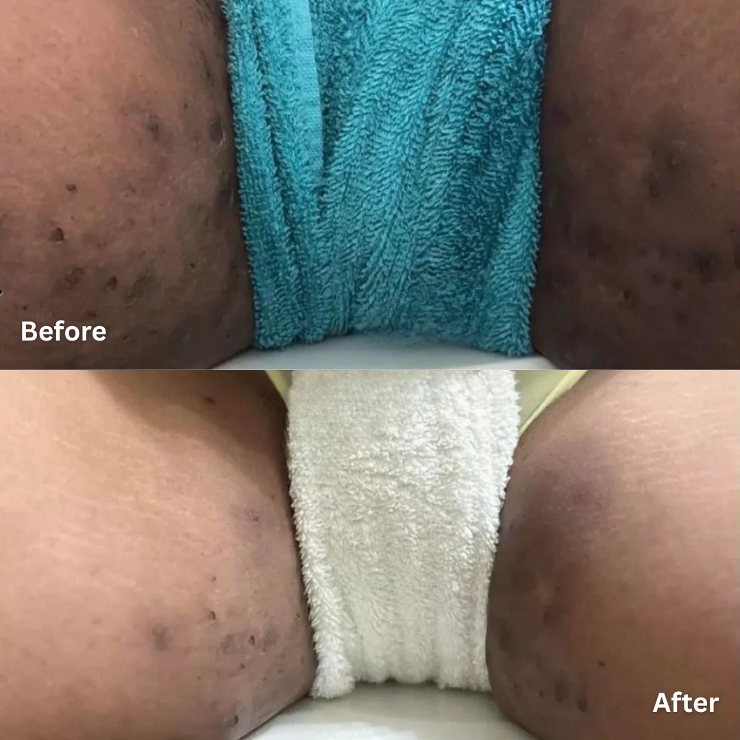 BeePropolis Overnight HS Flare-Up Relief Cream